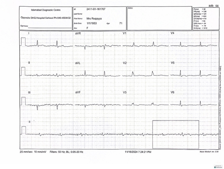 Ecg | PDF