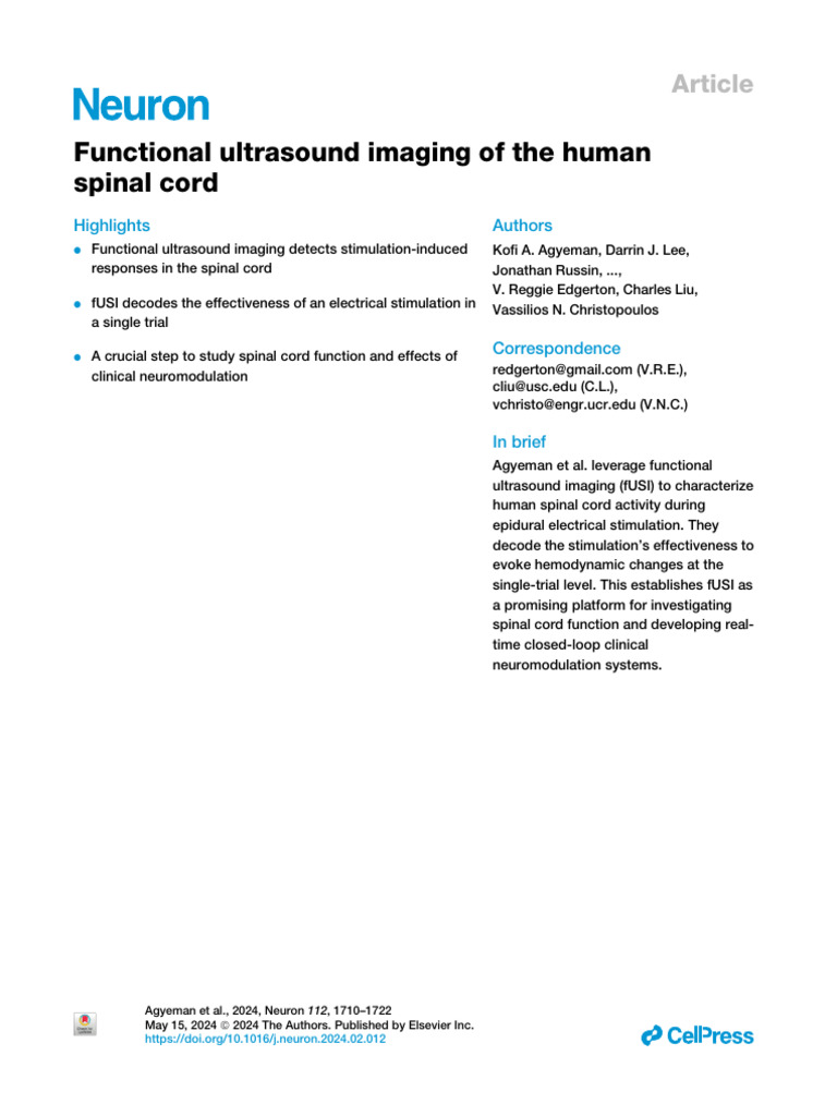 Functional Ultrasound Imaging of The Human Spinal Cord - 2024 - Neuron ...
