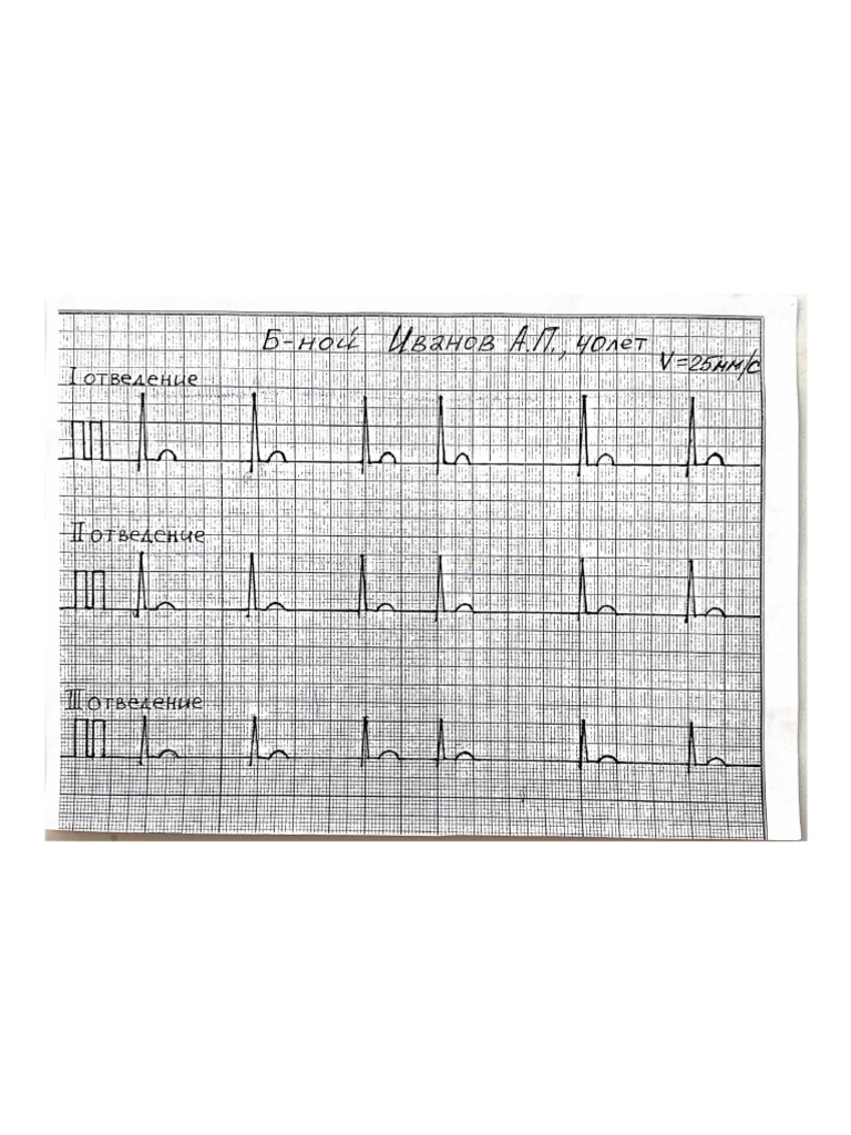 ECG 9. | PDF