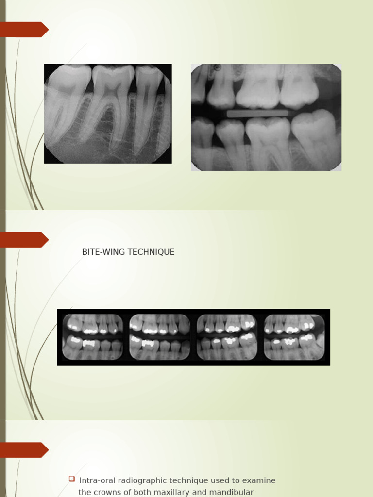 Bite-Wing Radiography Technique Guide | PDF