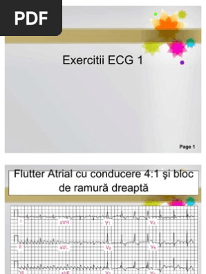 Exercitii Ecg Circulatory System Angiology