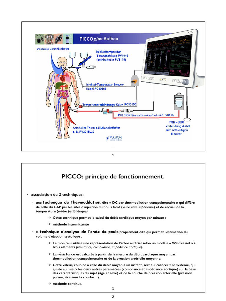 Monitorage Hémodynamique - PiCCO | PDF | Tension artérielle ...