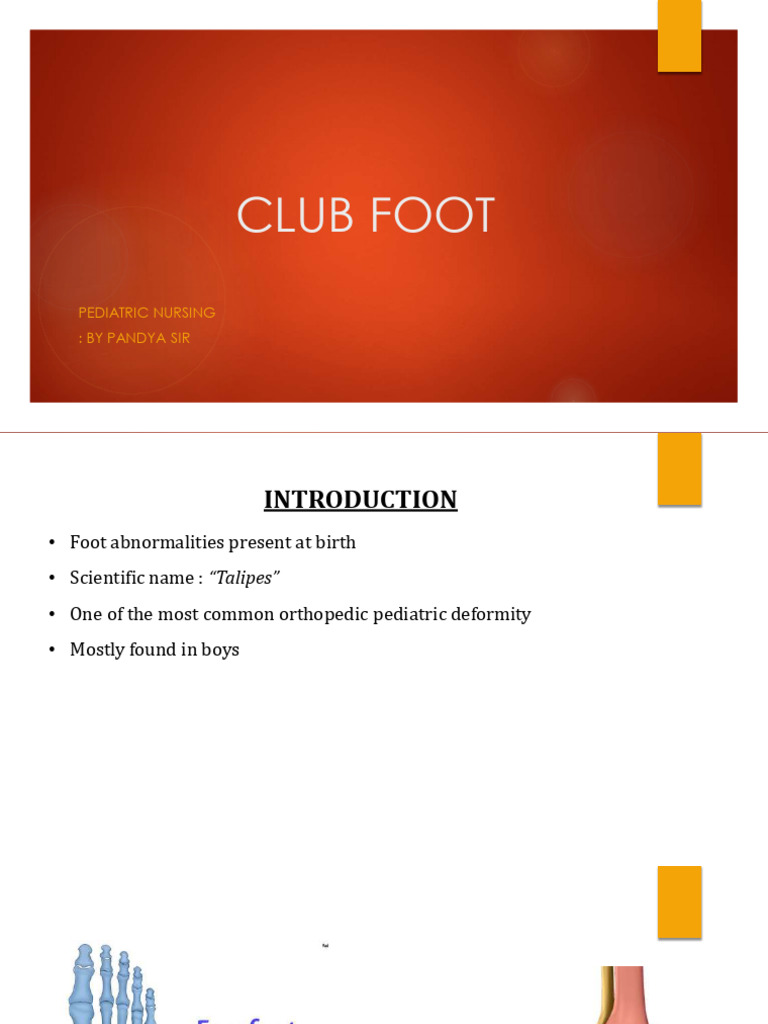 Club Foot | PDF