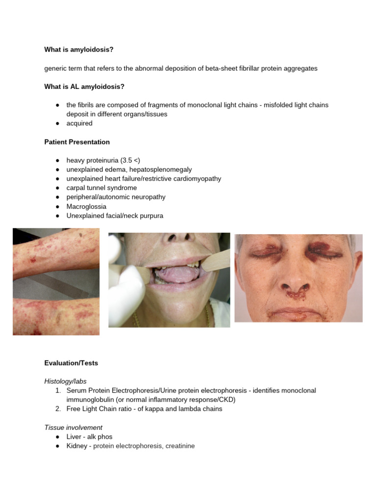 Understanding AL Amyloidosis Symptoms & Treatment | PDF