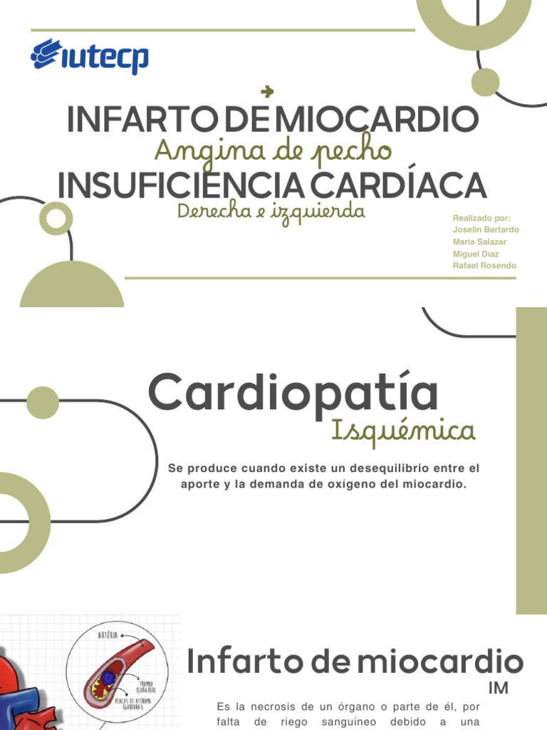 Taquicardia y su relación con infartos | PDF | Infarto de miocardio ...