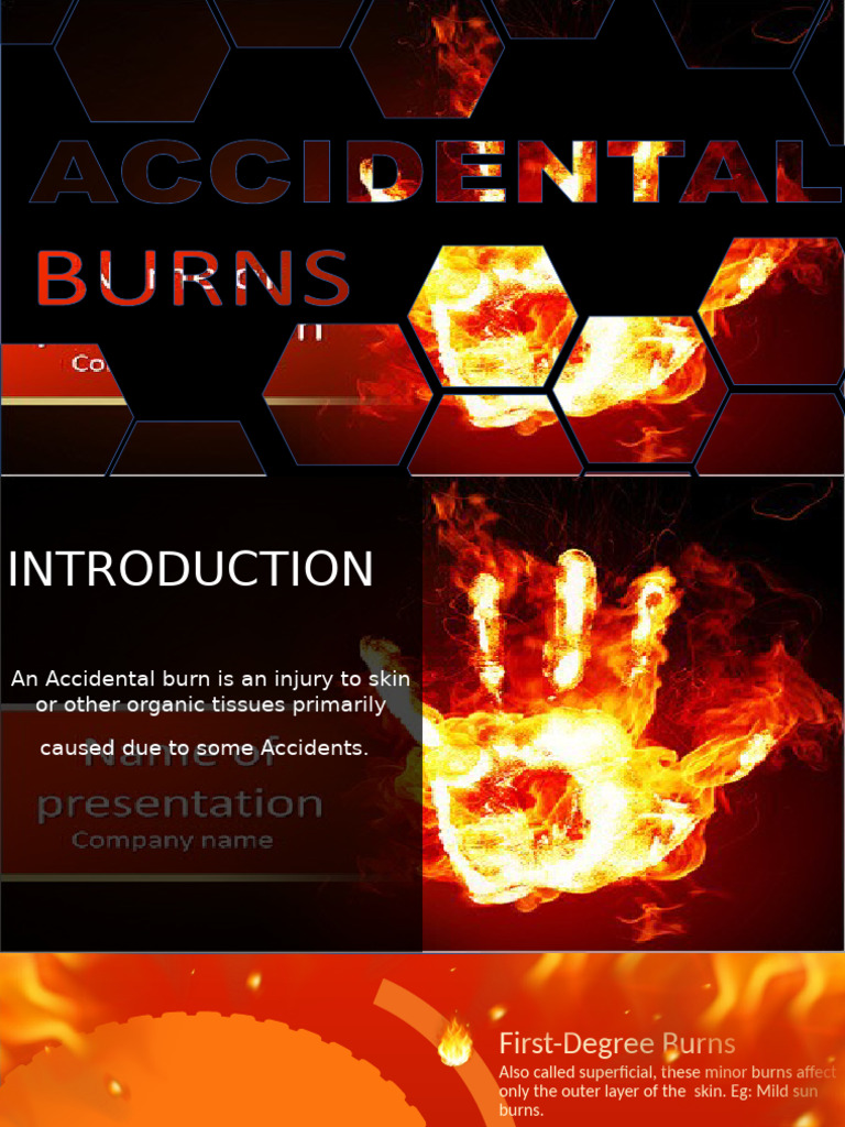 Understanding Accidental Burns Types | PDF