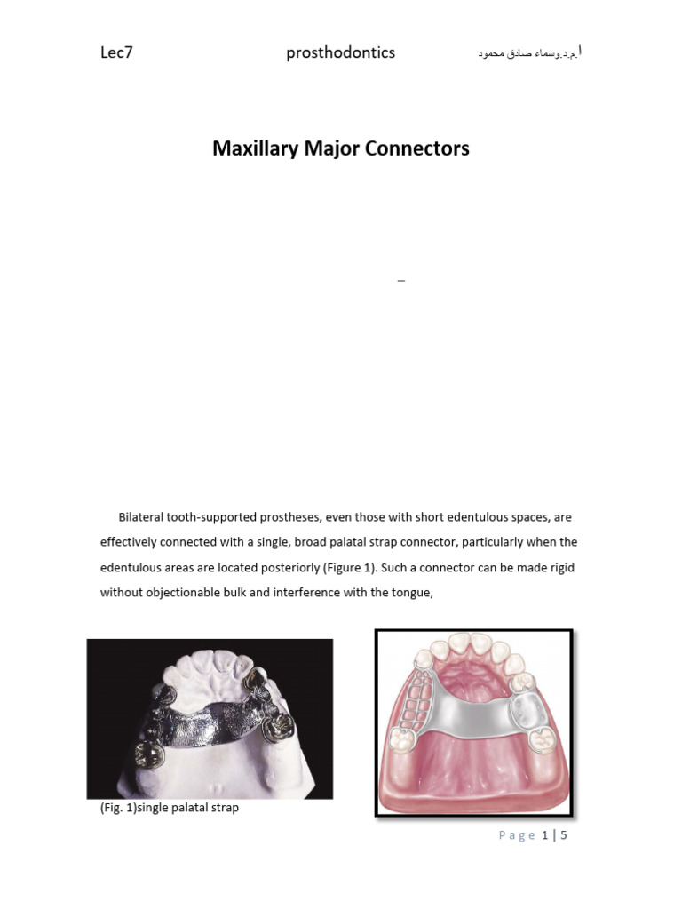 Types of Maxillary Major Connectors | PDF | Dentistry Branches