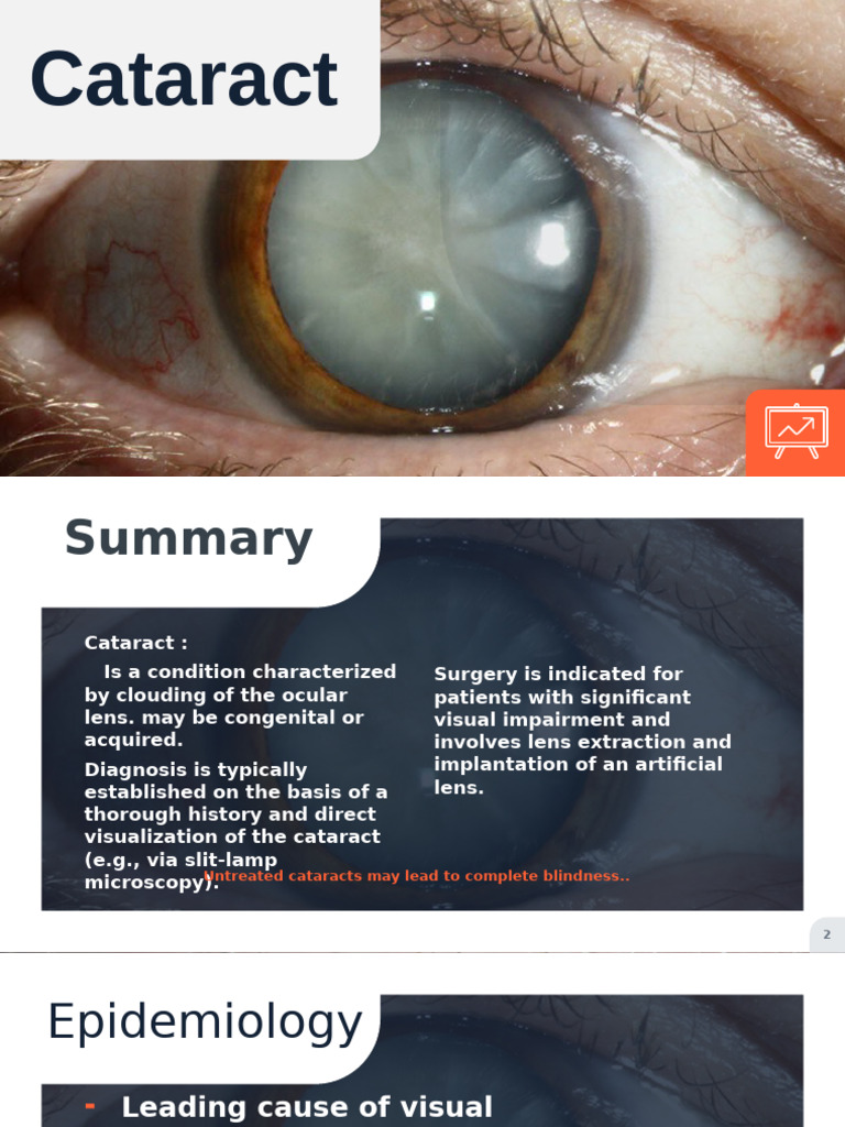 Understanding Cataracts: Causes & Treatment | PDF | Cataract | Visual ...