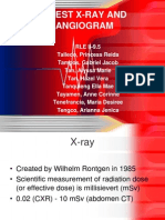 Chest X-ray and Coronary Computed Tomography Angiogram