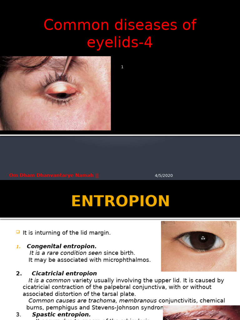 Disease of Eyelid 4 | PDF | Ophthalmology | Diseases And Disorders