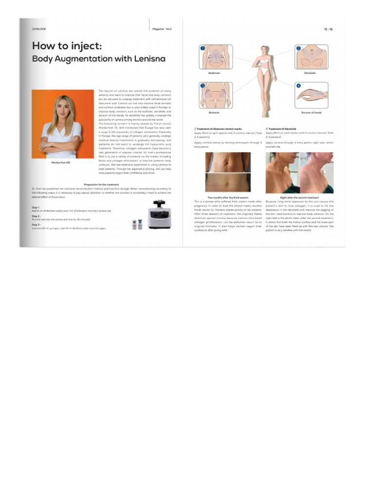 lenisna | PDF
