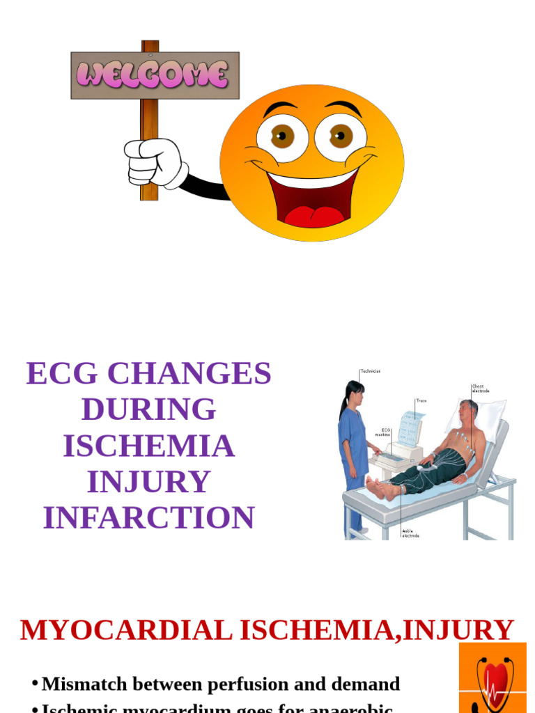 ECG Changes in Myocardial Ischemia | PDF | Electrocardiography ...