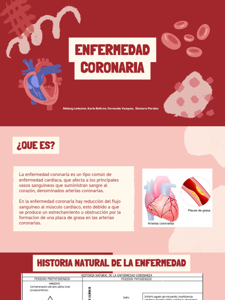 Enfermedad Coronaria: Diagnóstico y Manejo | PDF | Dolor | Infarto de ...