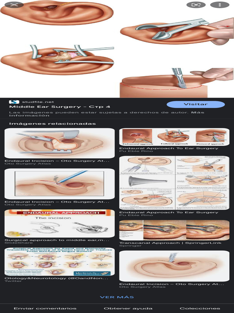 Incision Endaural - Búsqueda de Google | PDF