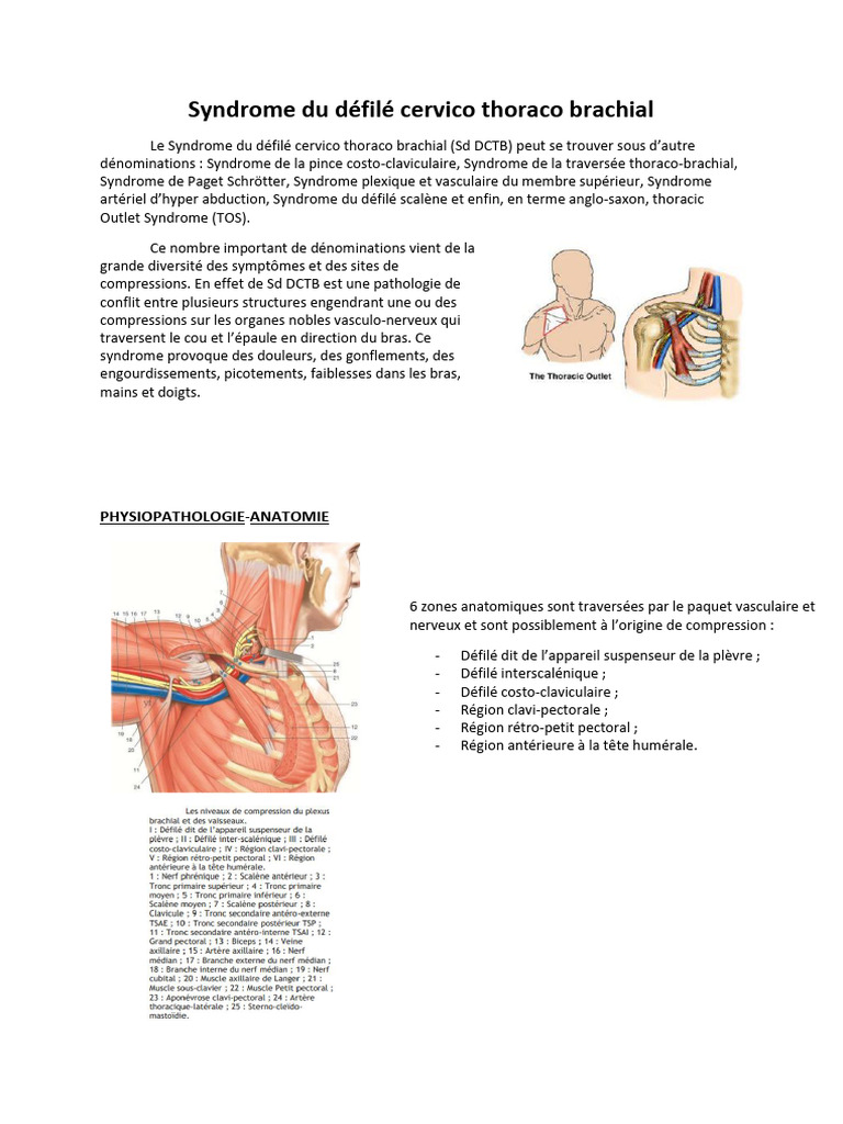 Syndrome du défilé cervicothoracobrachial PDF Médecine clinique — free download