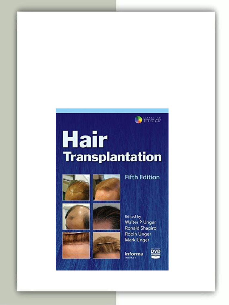 Hair Transplantation Fifth Edition（洋書） Hair Transplantation 5th Editiondownload | PDF | Hair
