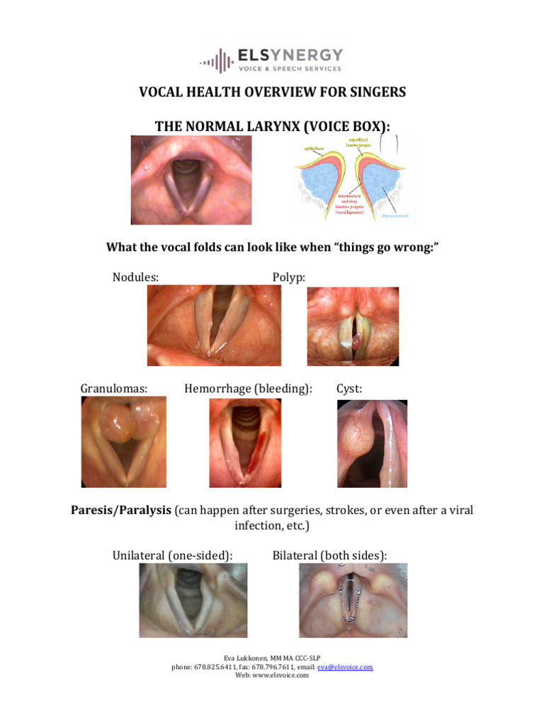 Vocal Health Tips for Singers | PDF | Human Voice | Singing