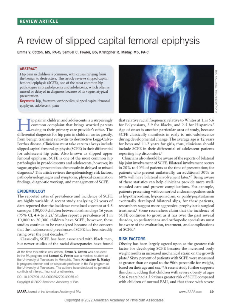 Understanding Slipped Capital Femoral Epiphysis | PDF | Medical Imaging ...