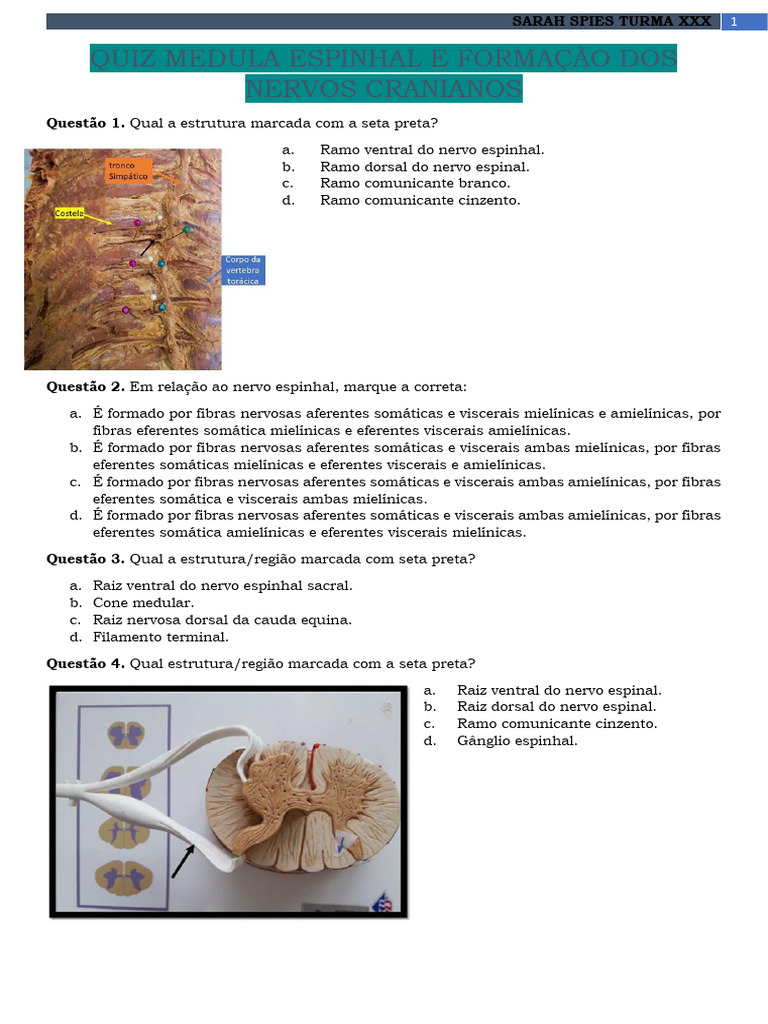 Quiz sobre Medula Espinhal e Nervos Cranianos | PDF | Nervo | Medula ...