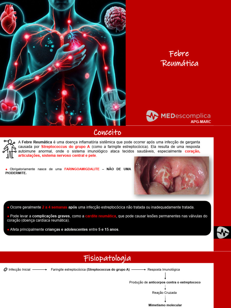 Febre Reumática: Causas e Sintomas | PDF | Doenças e distúrbios ...