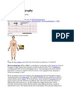 ECG