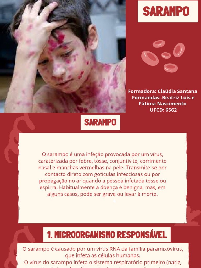 Entenda o Sarampo: Sintomas e Prevenção | PDF | Sarampo | Gravidez