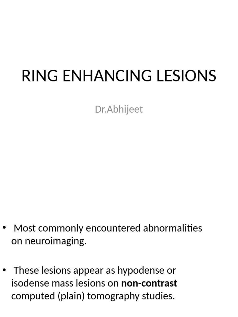 Understanding Ring-Enhancing Lesions | PDF | Neurological Disorders ...