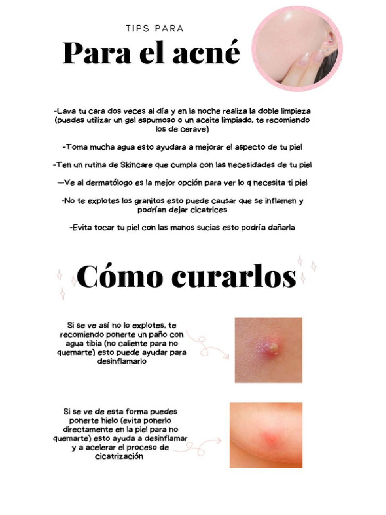 Como Curar El Acne | PDF