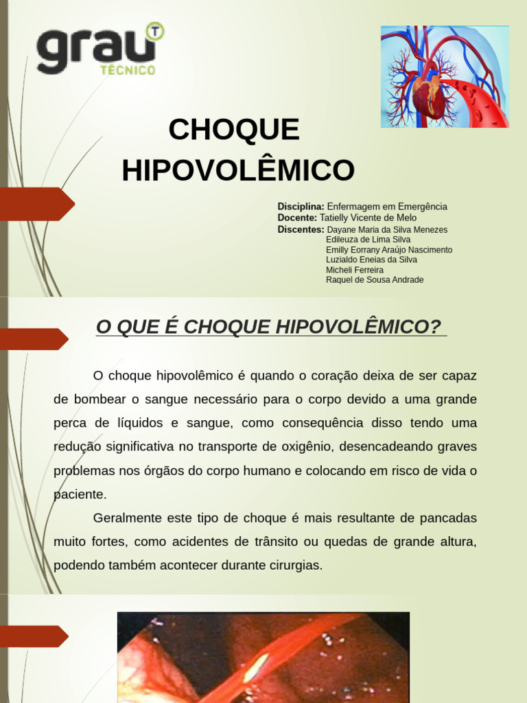 Choque Hipovolêmico: Causas e Tratamento | PDF | Choque (circulatório ...
