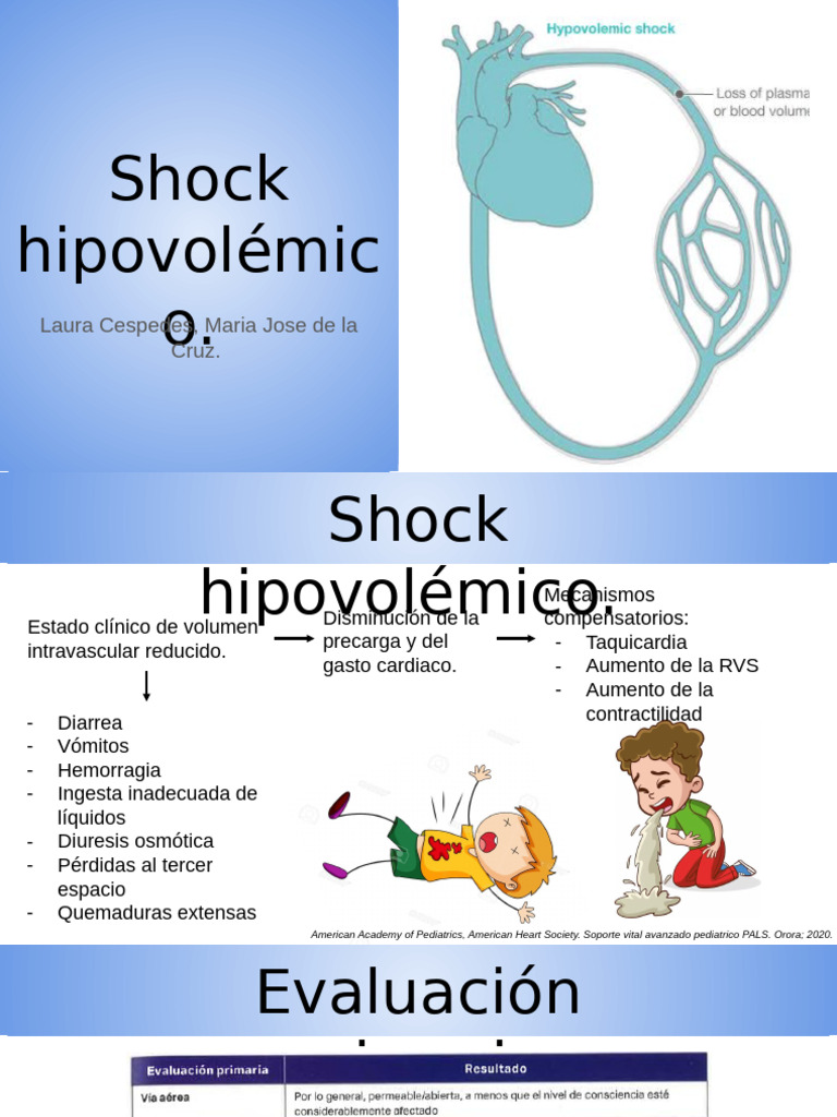 Manejo del Shock Hipovolémico en Pediatría | PDF | Sistema ...