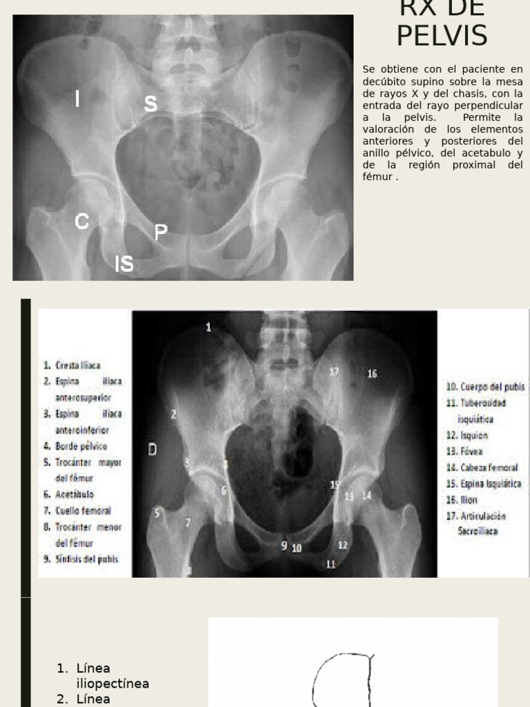 Proyeccciones Pelvis | PDF | Pelvis | Sistema esquelético