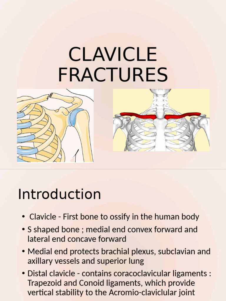 Clavicle Fractures | PDF