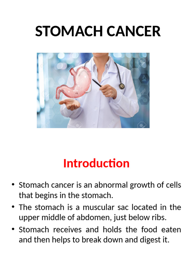 Understanding Stomach Cancer: Risks & Stages | PDF | Stomach | Cancer