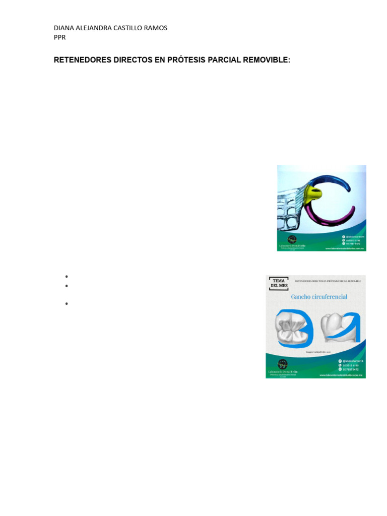 Retenedores Directos en Prótesis Parcial Removible | PDF | Diente ...