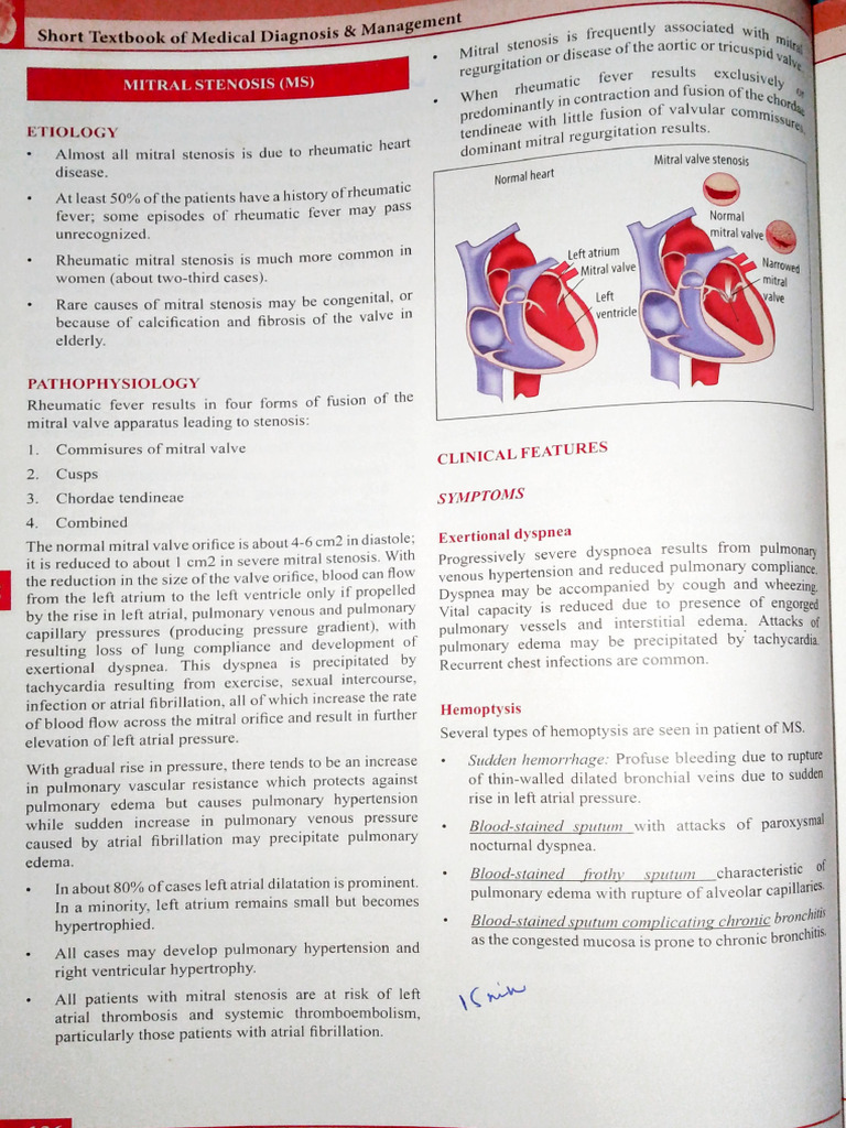 Mitral Stenosis: Diagnosis and Management | PDF | Heart Valve ...