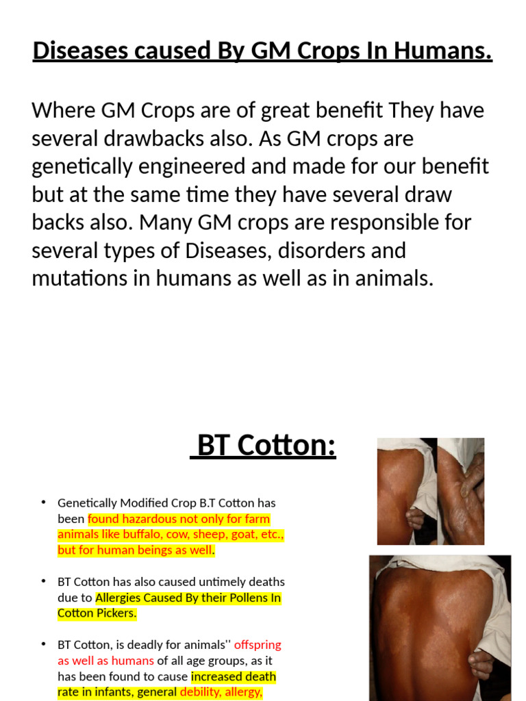 Health Risks of GM Crops in Humans | PDF | Allergy | Soybean