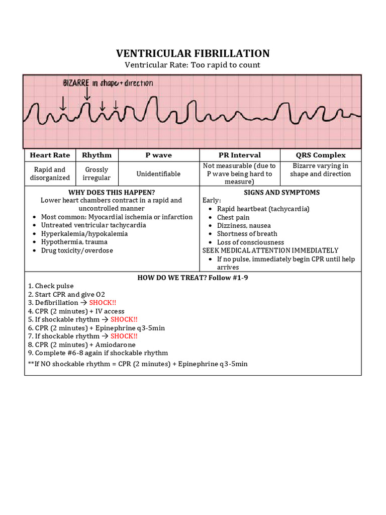 Ventricular Fibrillation: Ventricular Rate: Too Rapid To Count | PDF ...