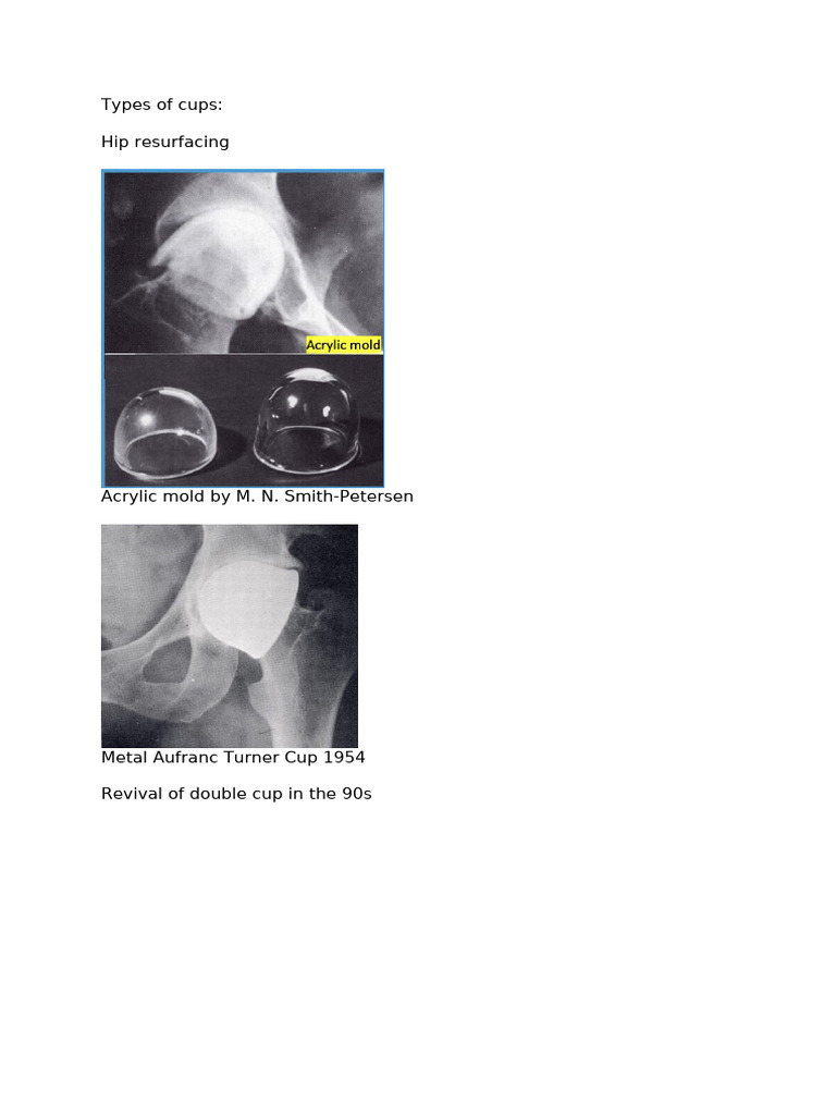 Types of Cups | PDF