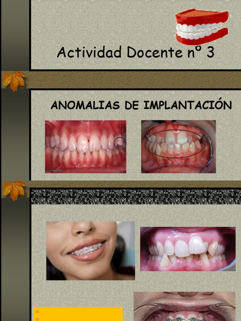Anomalías de Implantación y Oclusión Dental | PDF | Ortodoncia | Ramas ...