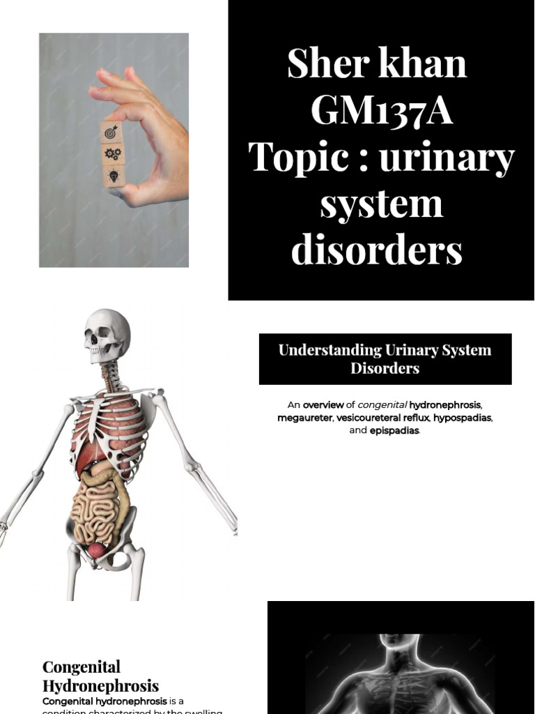 Overview of Urinary System Disorders | PDF | Urinary System | Medicine