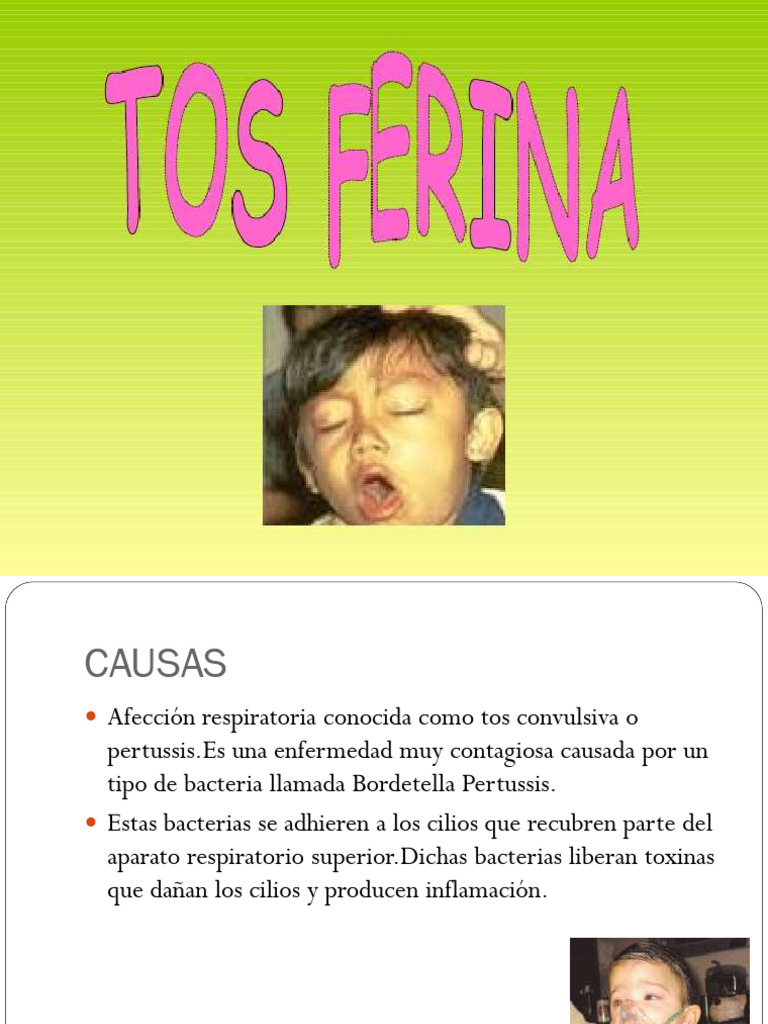 4 Tosferina | PDF