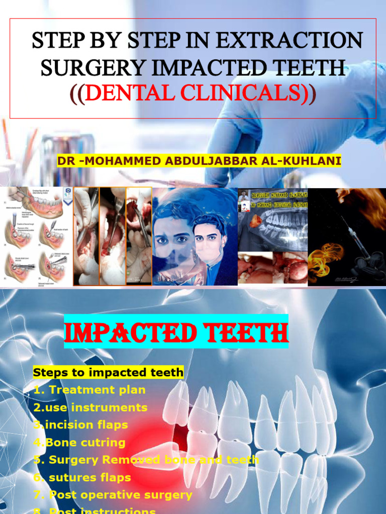 Step Extraction Surgery Impact | PDF