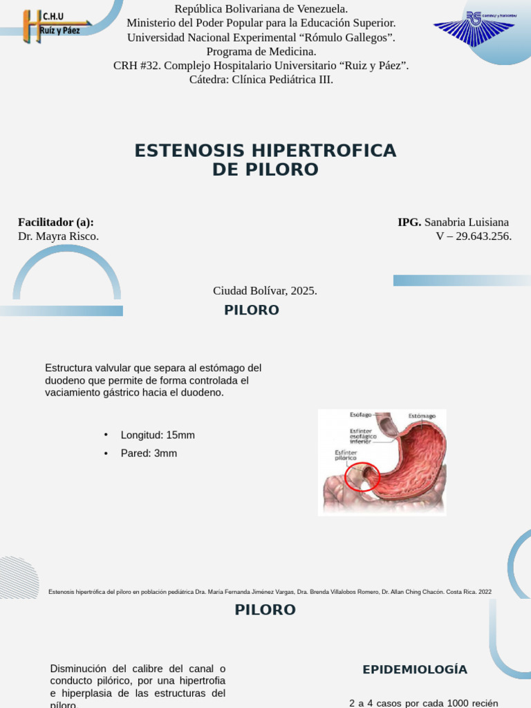 Estenosis Hipertrofia del Píloro en Bebés | PDF | Estómago | Vómitos