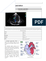 Ventricular Septal Defect