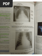 ABCDE Approach to Chest X-Ray Interpretation | PDF | Lung | Thorax