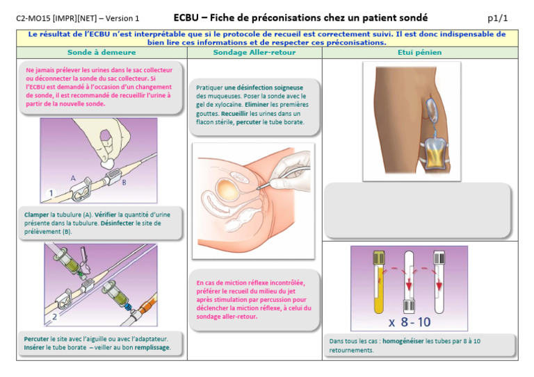 Protocole ECBU pour patients sondés | PDF | Urologie | Appareil urinaire