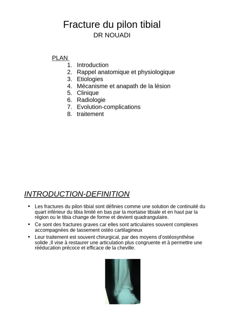 Fracture du pilon tibial : diagnostic et traitement | PDF | Pied | Genou