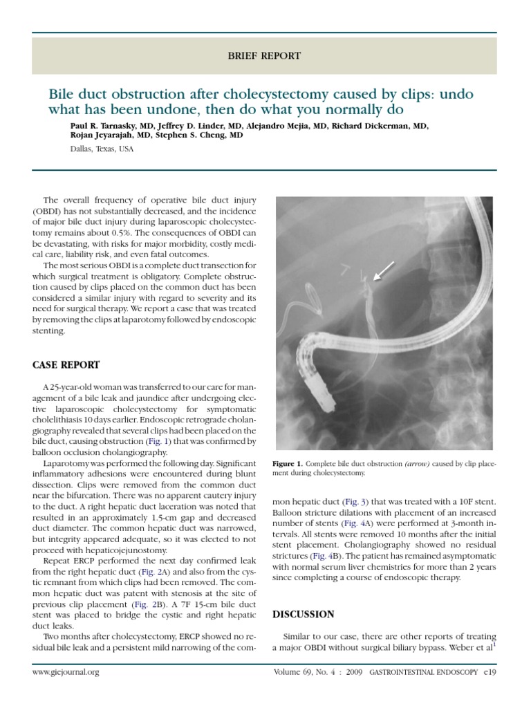 Image Result For Icd Cm Code For Obstruction Of Bile Duct K Aapc