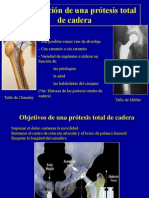 2 - Tecnicas para Protesis Totales de Cadera