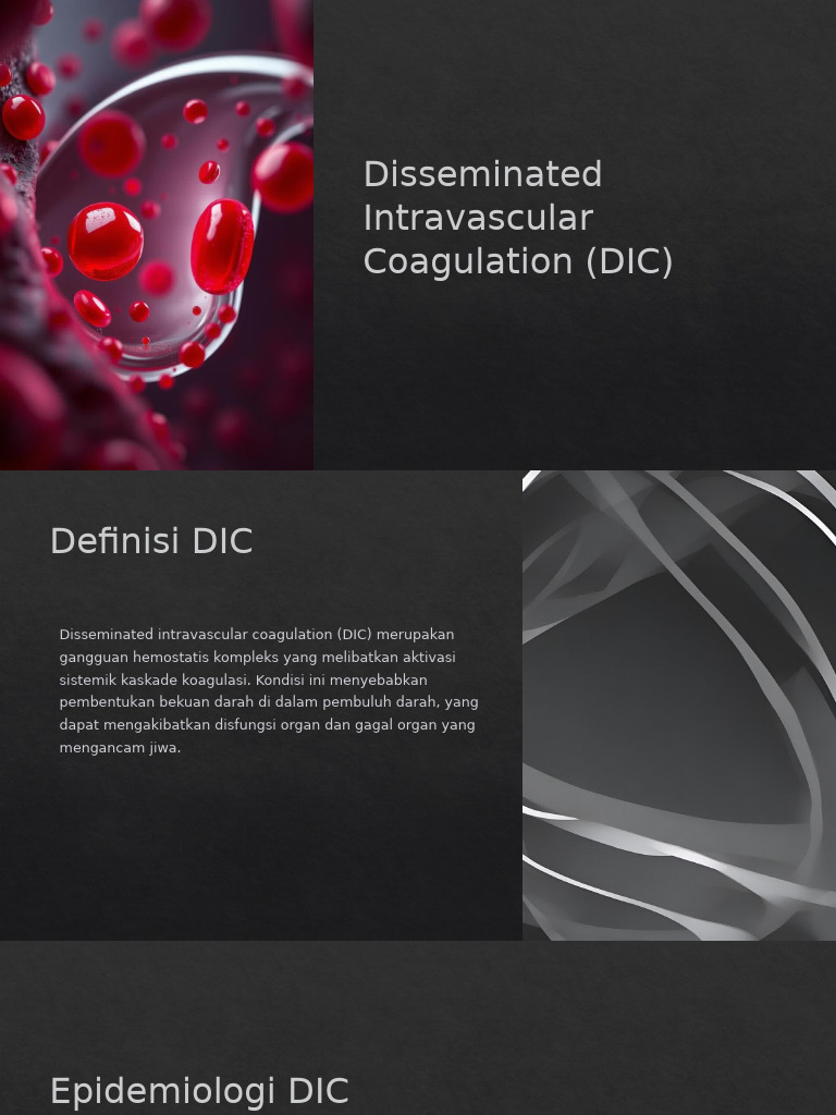 Disseminated Intravascular Coagulation DIC | PDF